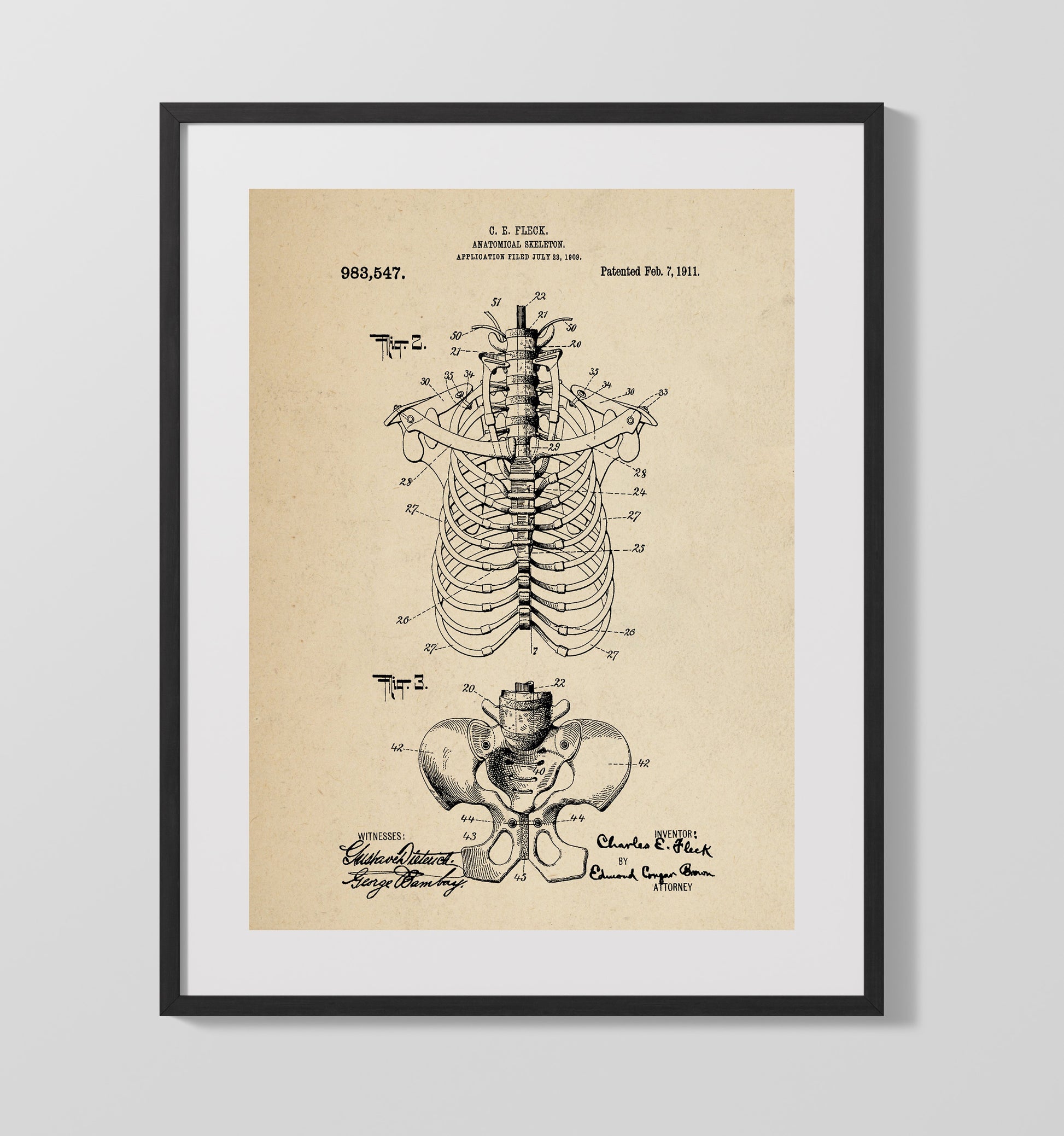 Patent Print - Anatomical Skeleton - Charles E. Fleck - 1911 - Patent 983547 Patent Wall Art