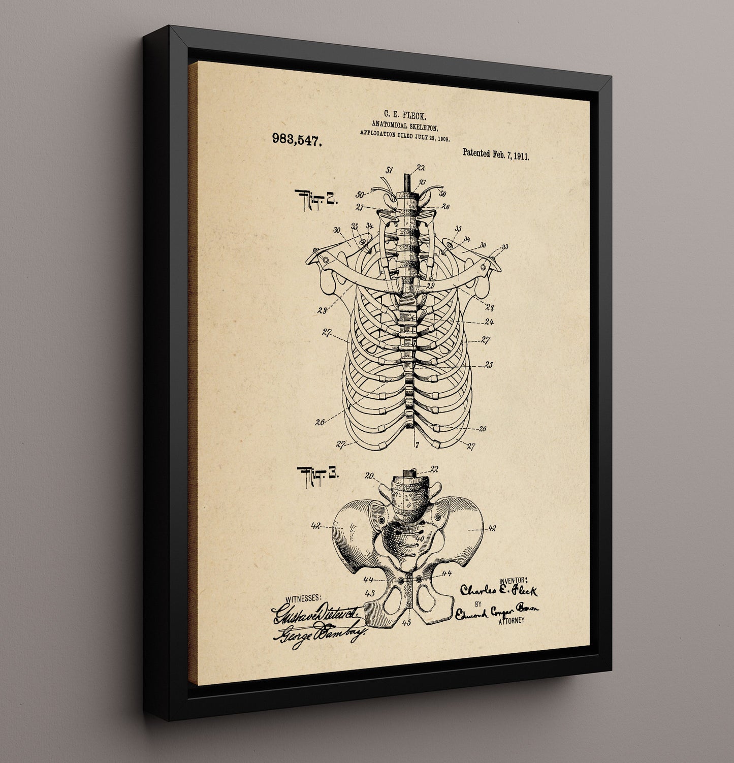Patent Print - Anatomical Skeleton - Charles E. Fleck - 1911 - Patent 983547 Patent Wall Art
