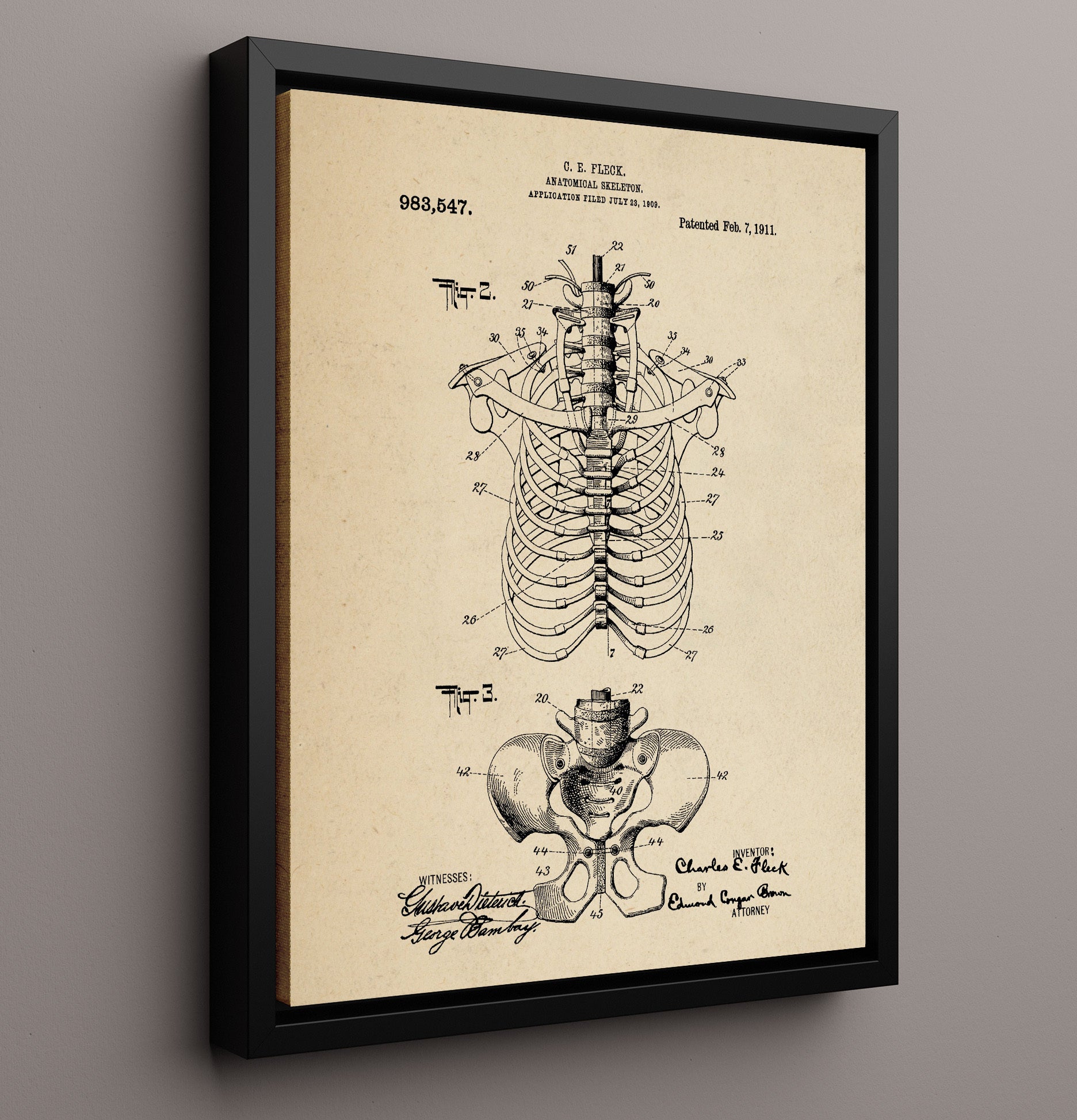 Patent Print - Anatomical Skeleton - Charles E. Fleck - 1911 - Patent 983547 Patent Wall Art