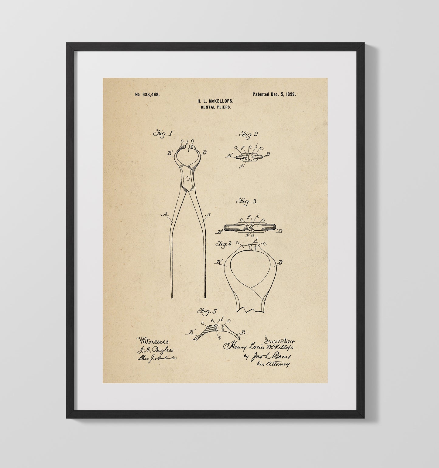 Patent Print - Dental Pliers - Henry Louis Mckellops - 1899 - Patent 638468 Patent Wall Art
