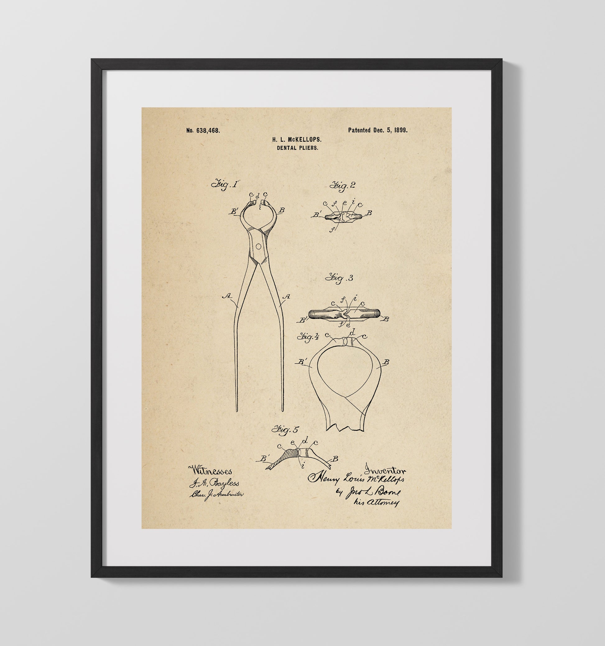 Patent Print - Dental Pliers - Henry Louis Mckellops - 1899 - Patent 638468 Patent Wall Art