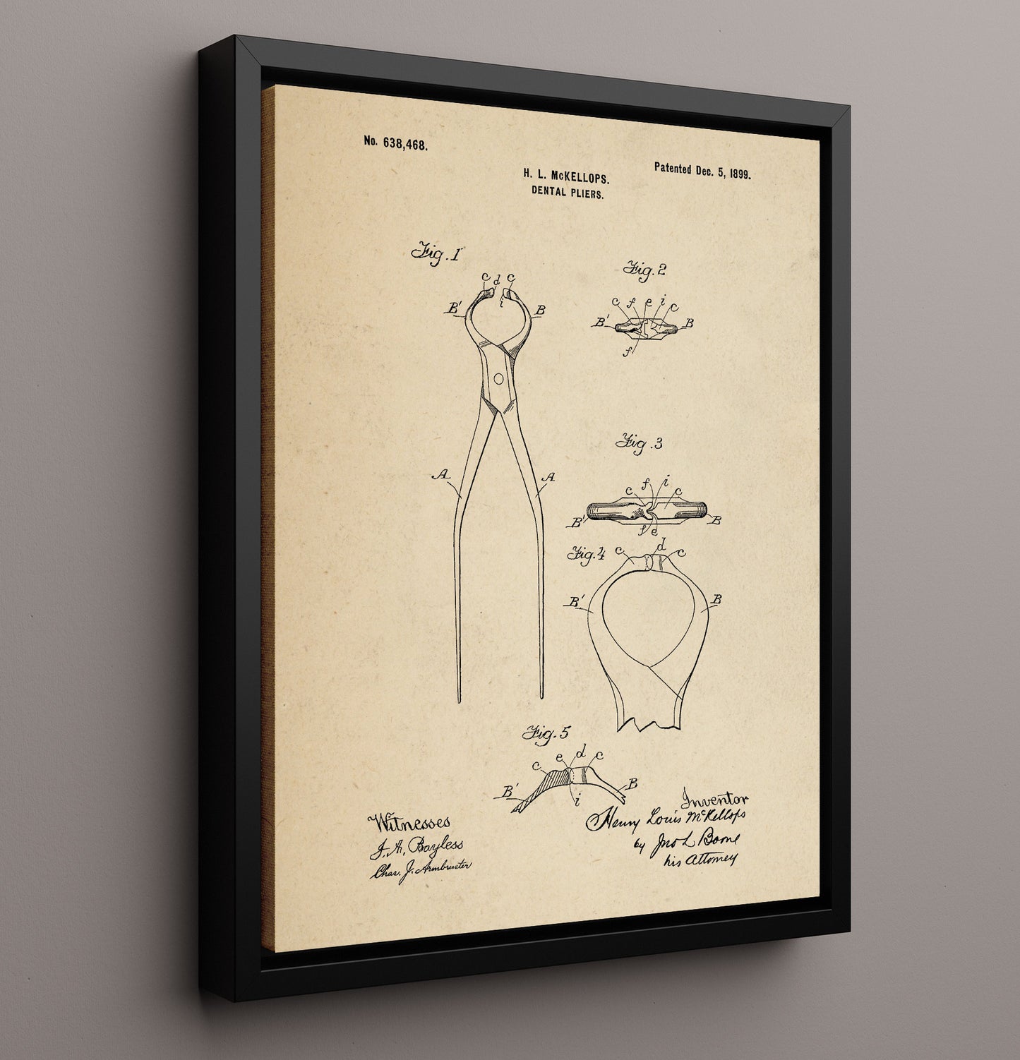 Patent Print - Dental Pliers - Henry Louis Mckellops - 1899 - Patent 638468 Patent Wall Art