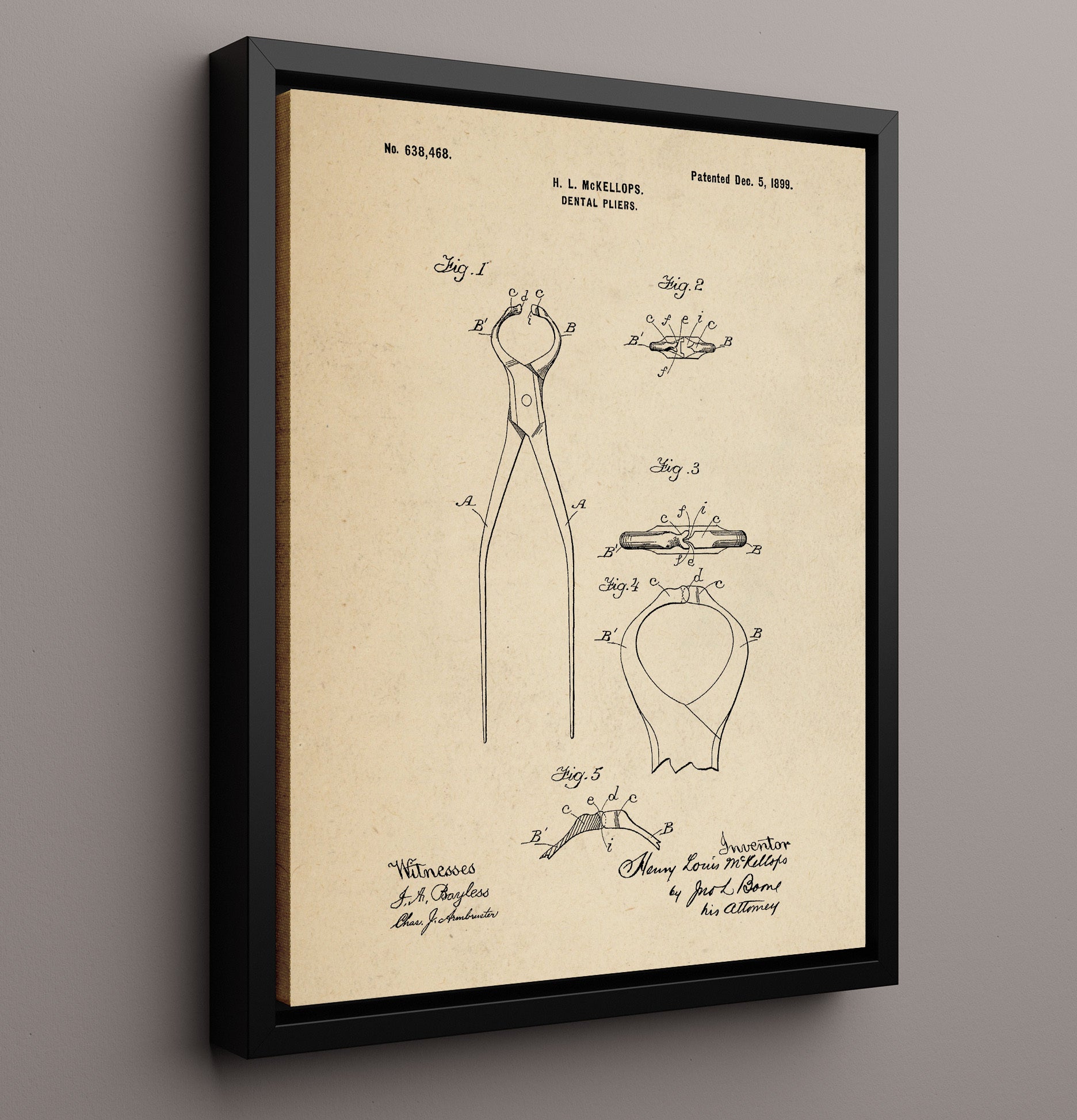 Patent Print - Dental Pliers - Henry Louis Mckellops - 1899 - Patent 638468 Patent Wall Art