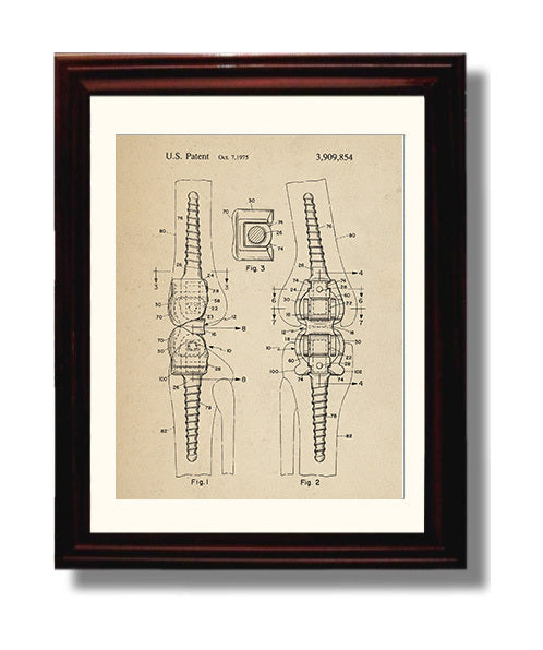 Patent Print - Orthopedic Bone Fastener - Internal Fixation Device - 1975 - Patent 3909854 Patent Wall Art