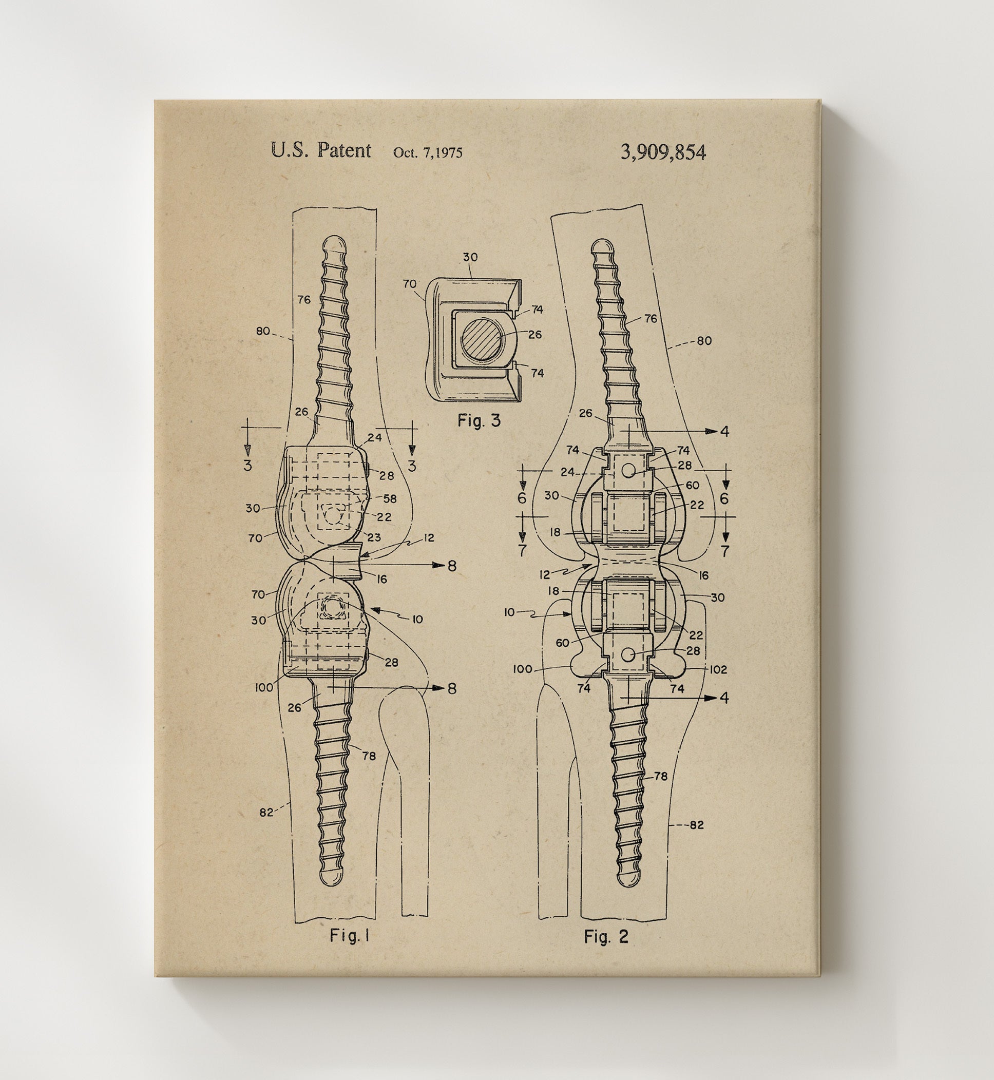 Patent Print - Orthopedic Bone Fastener - Internal Fixation Device - 1975 - Patent 3909854 Patent Wall Art