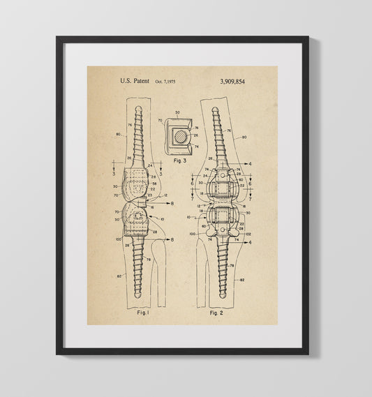 Orthopedic Bone Fastener - 1975 Patent - 16x20 Gallery Frame