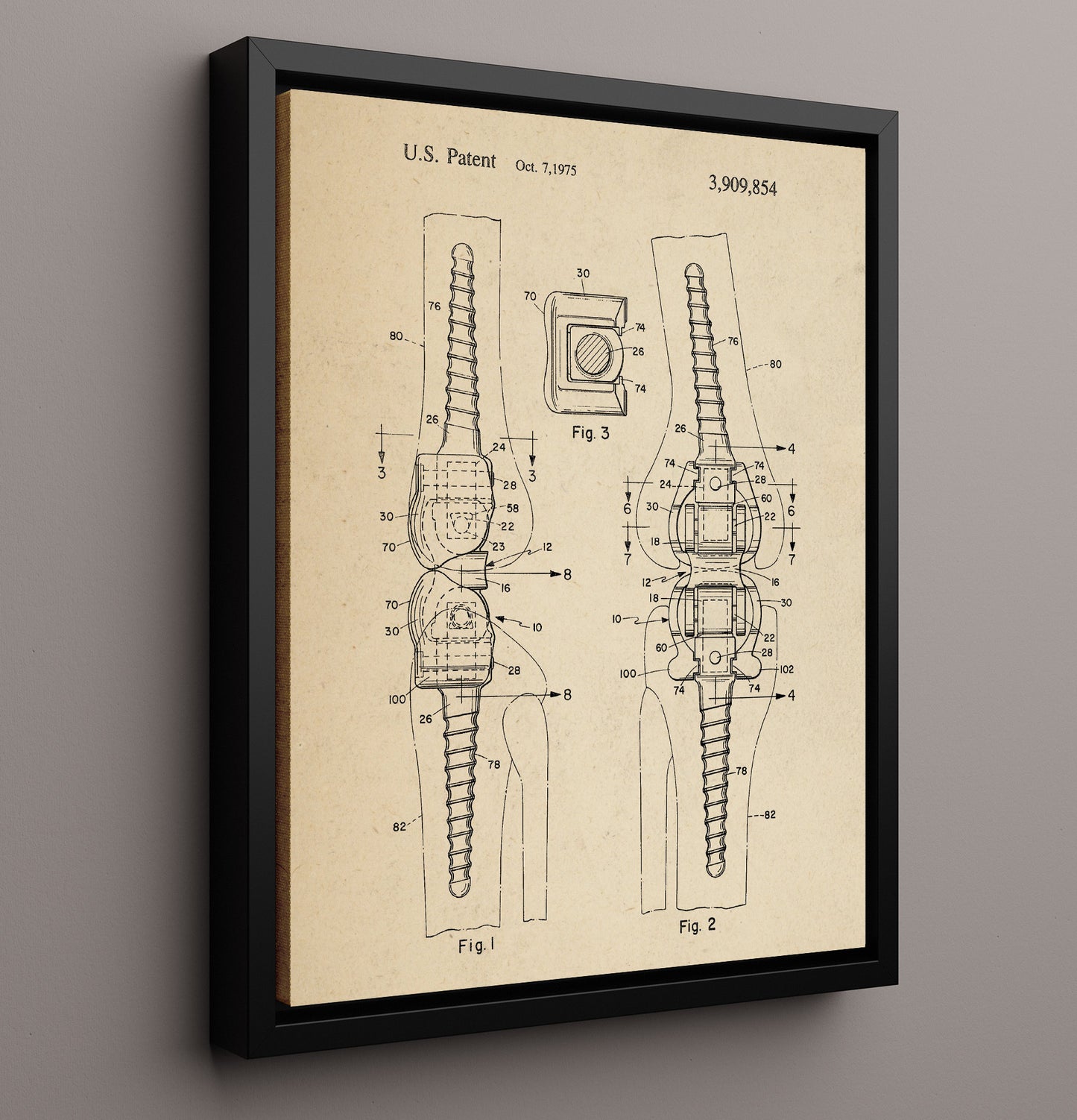 Patent Print - Orthopedic Bone Fastener - Internal Fixation Device - 1975 - Patent 3909854 Patent Wall Art