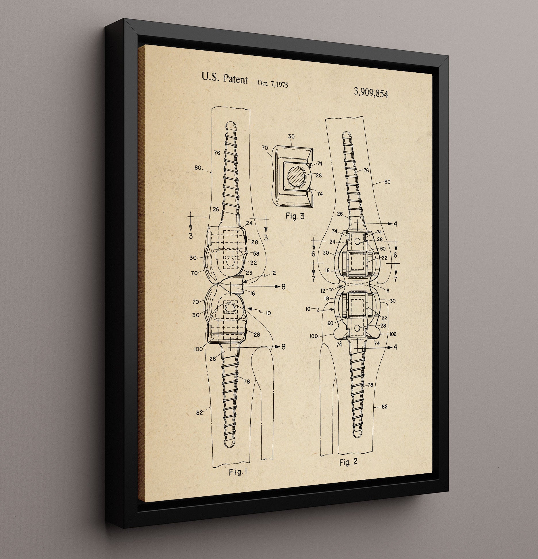 Patent Print - Orthopedic Bone Fastener - Internal Fixation Device - 1975 - Patent 3909854 Patent Wall Art